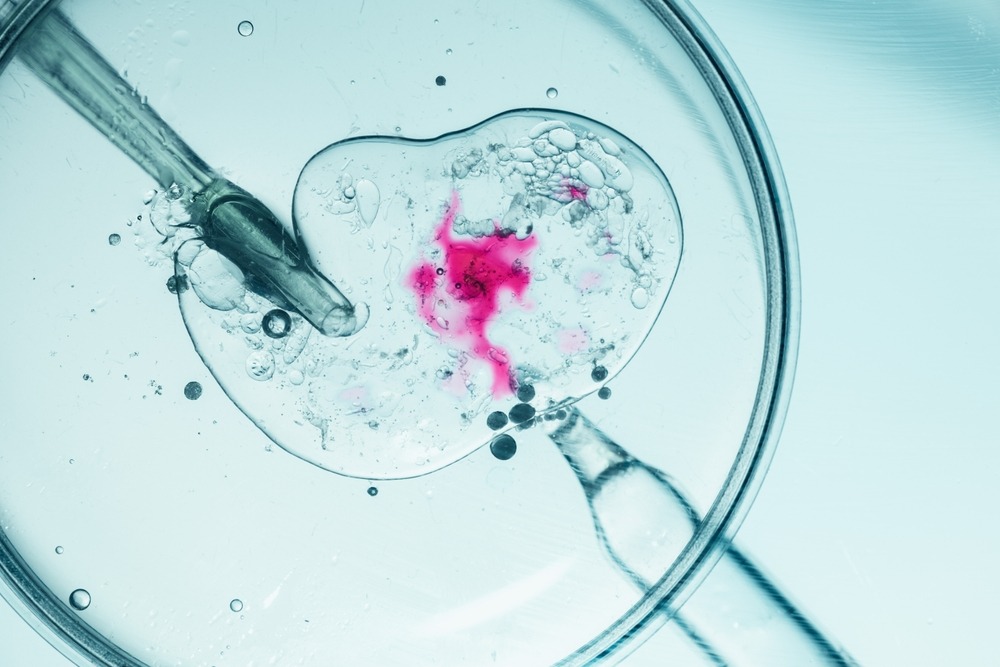Close-up Of In Vitro Fertilization Process With Vivid Colors
